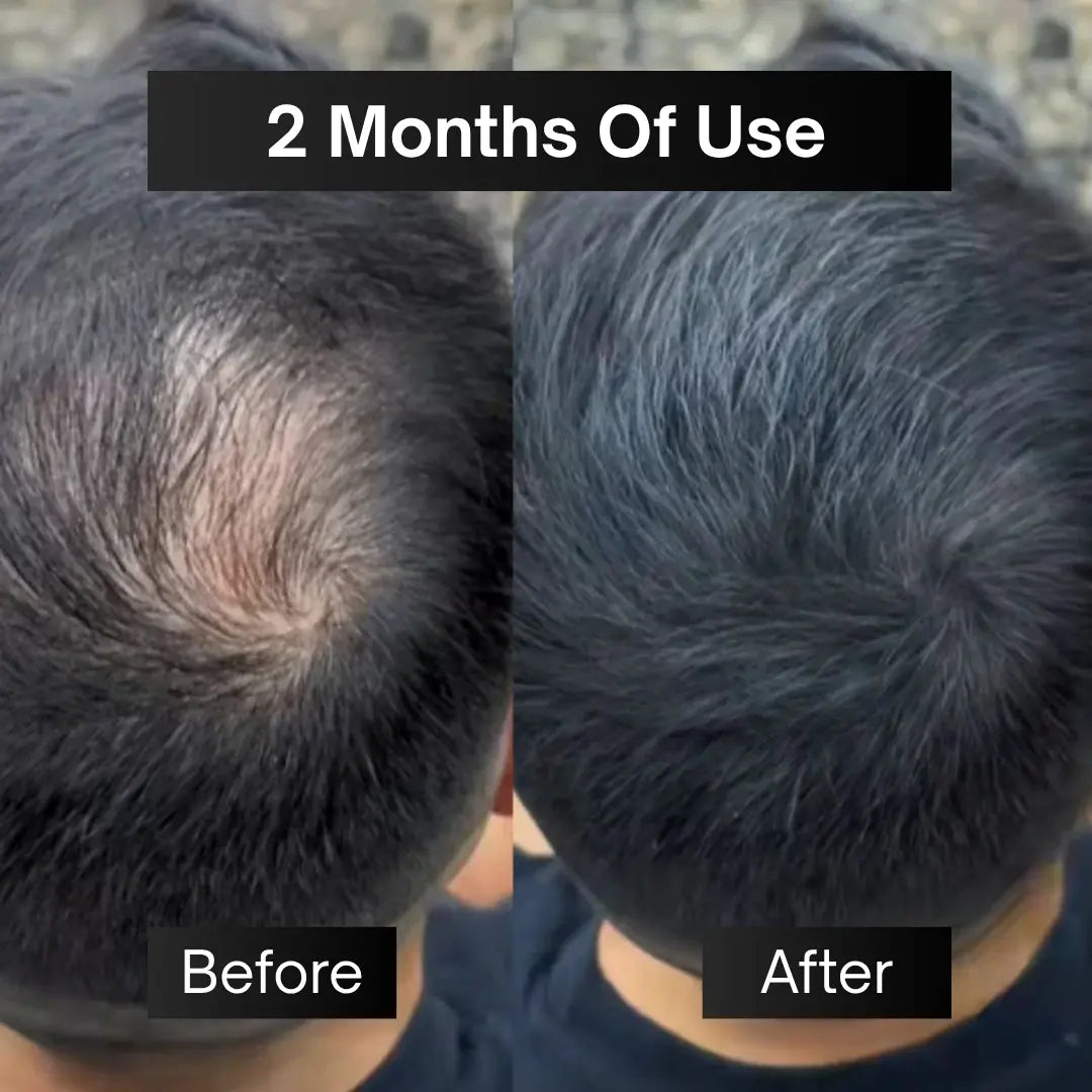 Natural Hair Growth Oil Serum