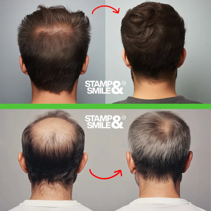 Natural Hair Growth Essential Oil Serum Stamp N Smile